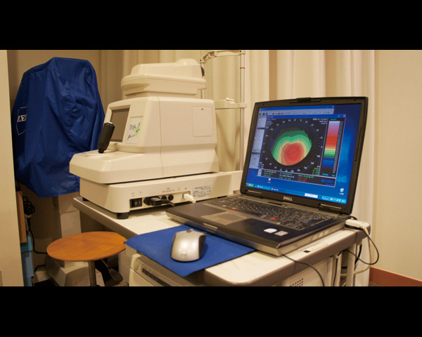 検査機器 角膜形状解析装置（TMS）
